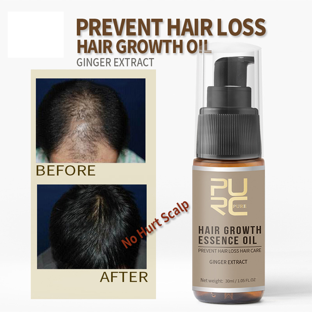 Best of 20ml / 30ml Hair Growth Oil Fast Hair Growth Products Scalp Treatments Prevent Hair Loss Thinning Beauty Hair Care For Men Women Reviews & Tips - Image 3