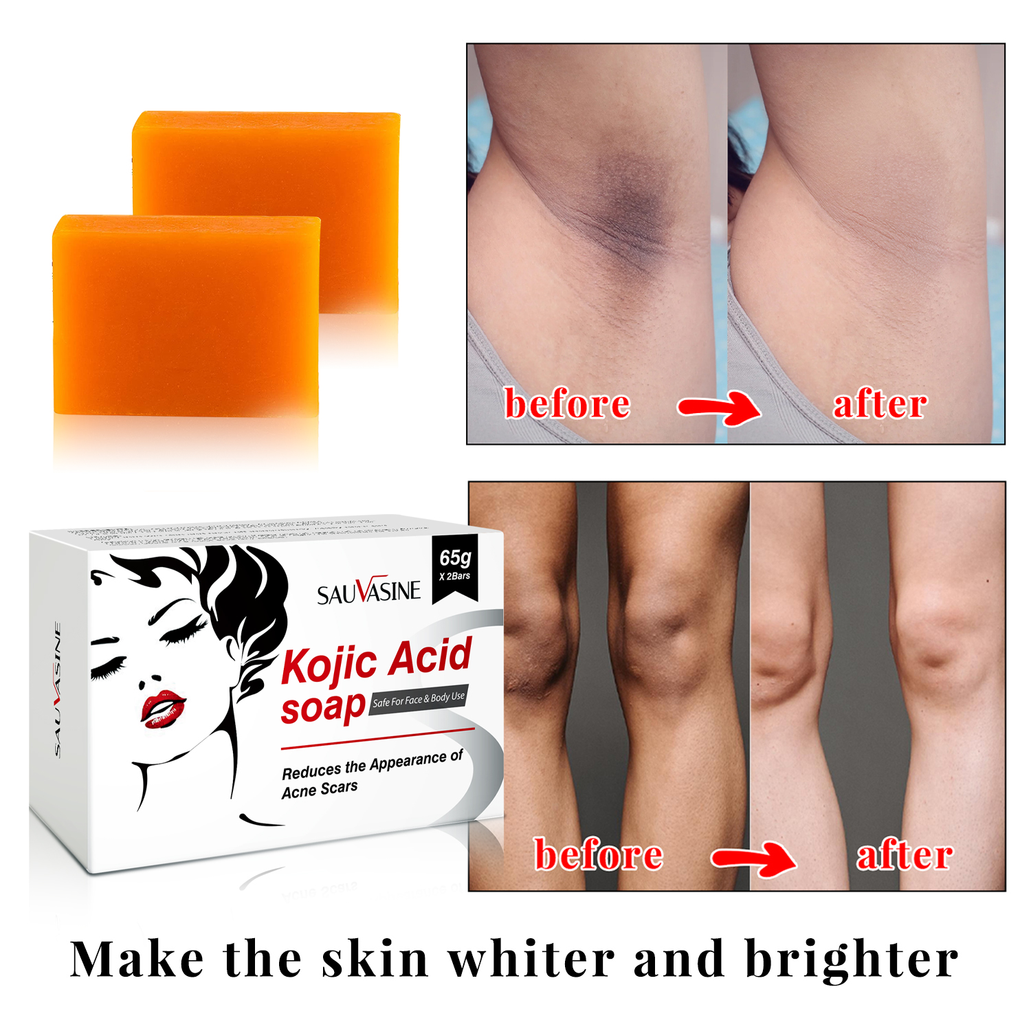 Best of Kojic Acid Whitening Soap 2 PCS Kit Handmake Reduce Drak Spot Melasma Deep Clean Brightening Skin Lightening Smooth Moisturized Reviews & Tips