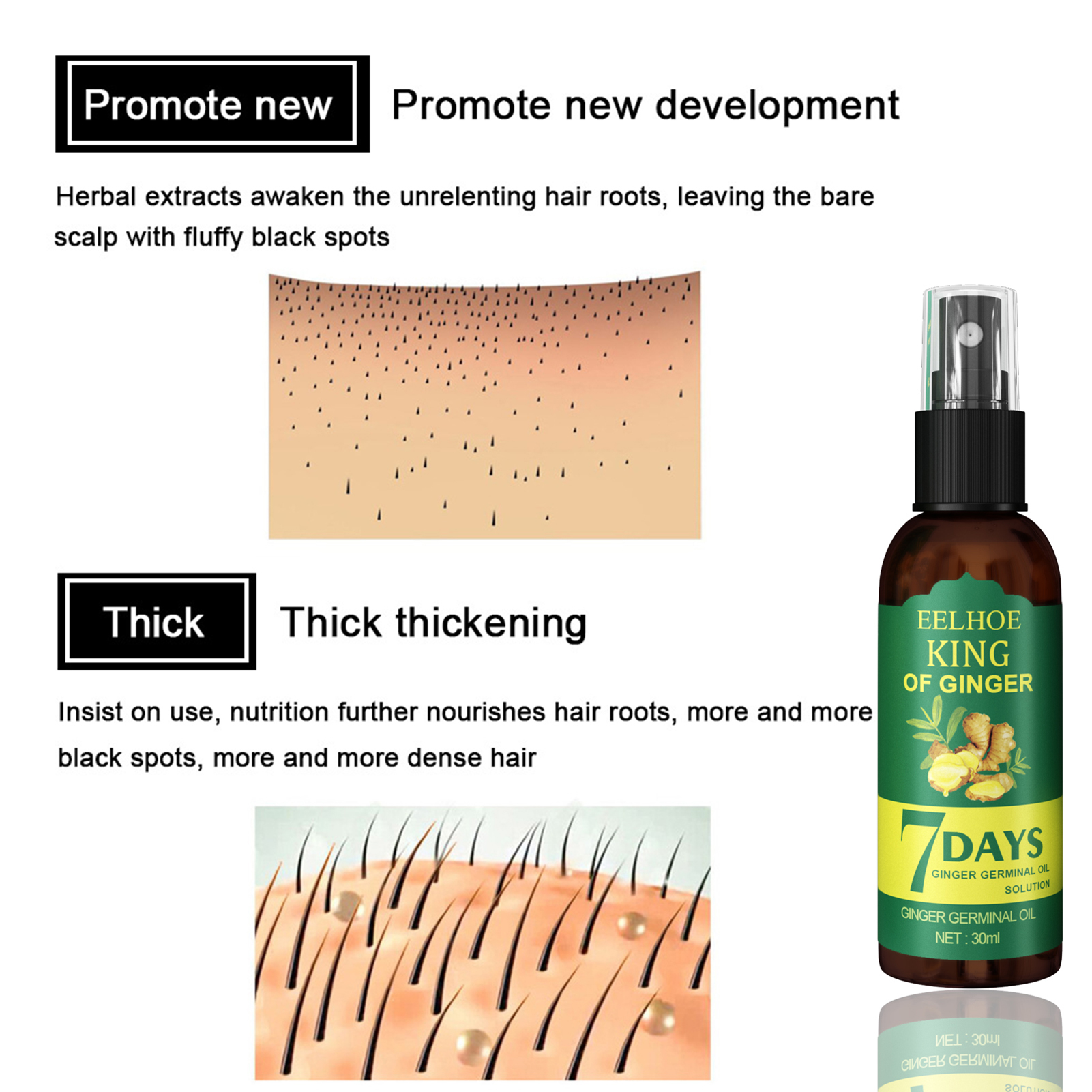 Best of Ginger Hair Growth Serum Sprayer Fast Hair Growth Dense Regrowth Ginger Serum Oil Natural Hair Growth Accelerator For Stronger Reviews & Tips - Image 5