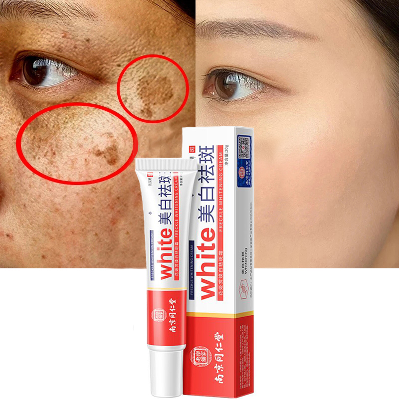 Best of Whitening Freckle Cream Remove Melasma Cream Remove Dark Spots Melanin Melasma Remover Brighten Skin Anti-Aging Skin Lightening Reviews & Tips