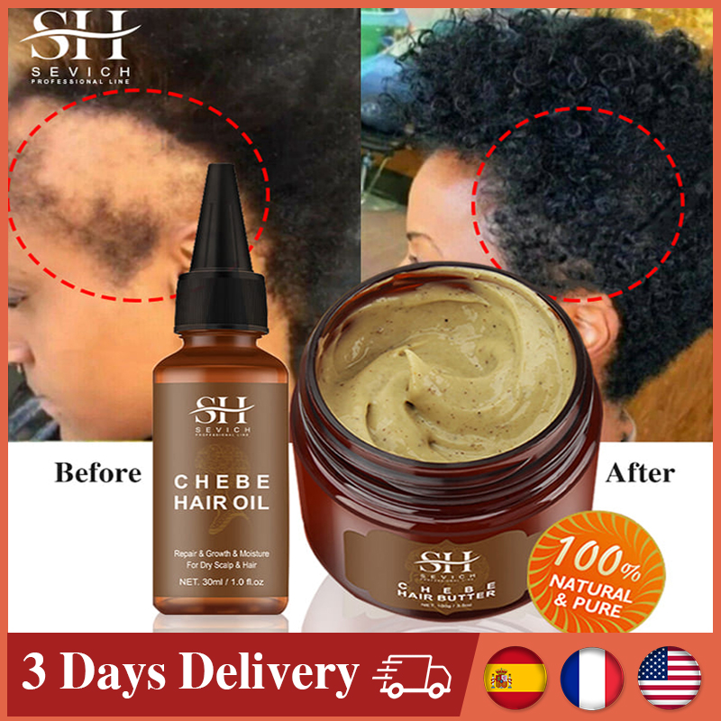 Best of Chebe Traction Alopecia Thicken Oil Anti Hair Loss Treatment Spray Craze Fast Hair Growth Products Sevich Anti Break Hair Care Reviews & Tips