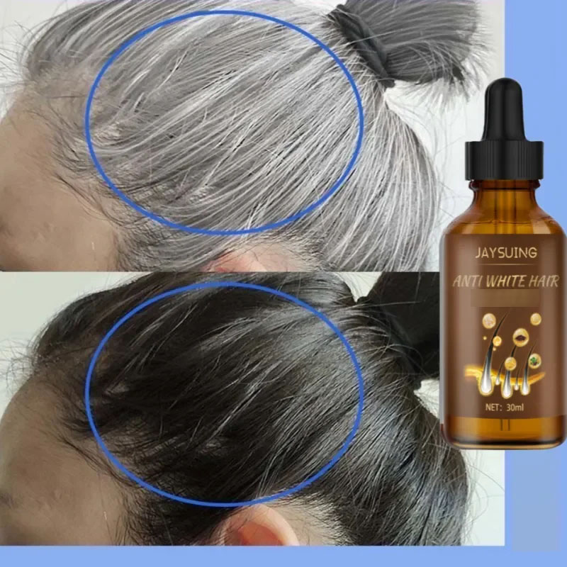 Best of Anti Gray Hair Treatment Serum White To Black Natural Color Repair Nourish Liquid For Men Women Anti Loss Hair Care Products Reviews & Tips