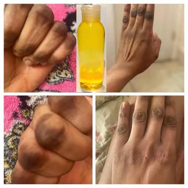 Best of Organic Effective Yellow Peeling Oil, Exfoliating Dead Skin Remover Reduce Dryness Roughness Hand Foot Knuckle Repair Care Serum Reviews & Tips