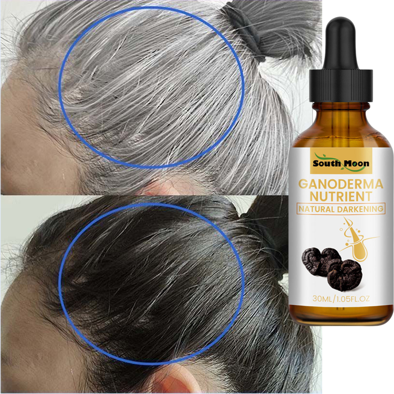 Best of Natural Anti Gray Hair Serum Remedy Treatment White Darkening Liquid Anti Loss Hair Color Repair Nourish Care Product Men Women Reviews & Tips