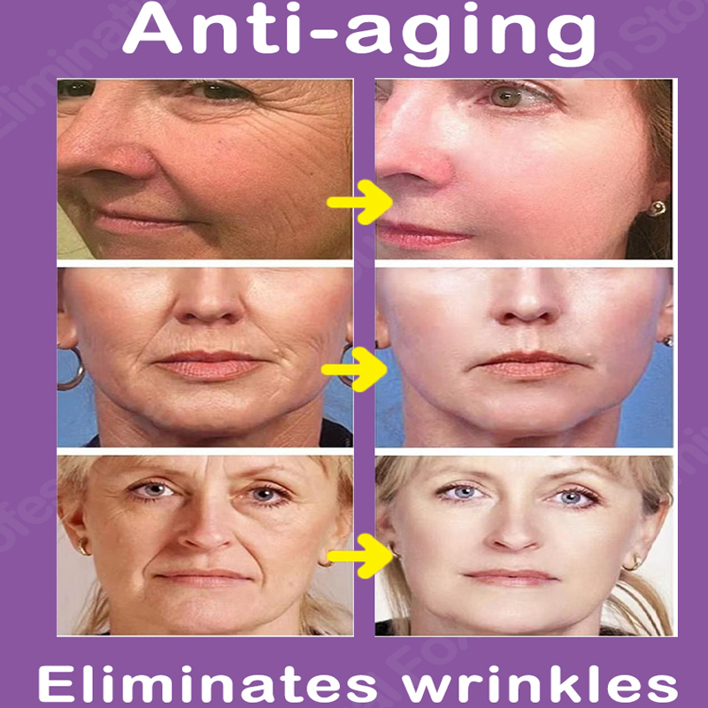 Best of Hyaluronic Acid Wrinkle Remover Serum Niacinamide Whitening Moisturizing Fade Dark Spot Shrink Pores 5 In 1 Facial Care Serum Reviews & Tips - Image 3