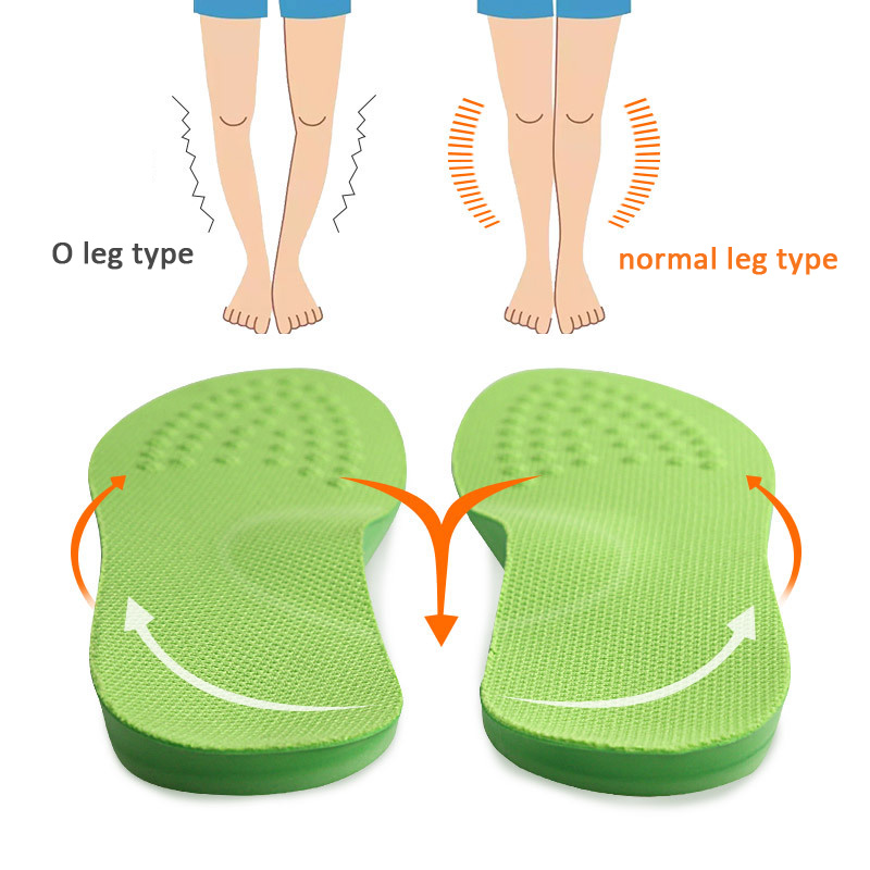 O/X-Leg Orthopädische Einlegesohlen zur Unterstützung des Fußgewölbes, orthopädische Einlegesohle, Valgus Varus-Schuhpolster, Massagepolster für Schuheinlagen, Sohle, Fußpflege – Detail 2