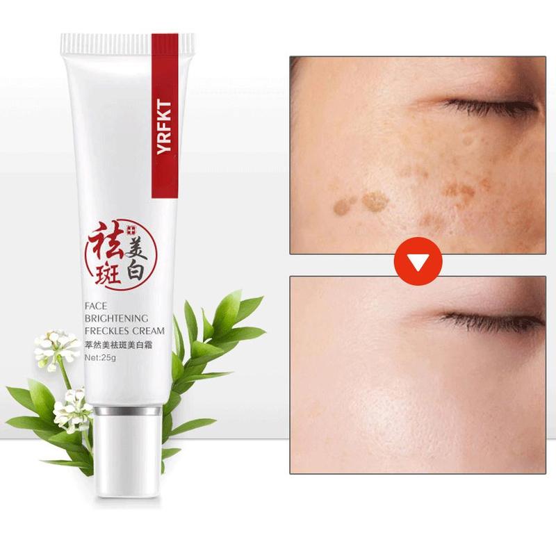 Best of Face Cream Collagen Freckles Whitening Day Cream Hyaluronic Acid Anti-Aging Anti-Wrinkle Remove Spot Reviews & Tips