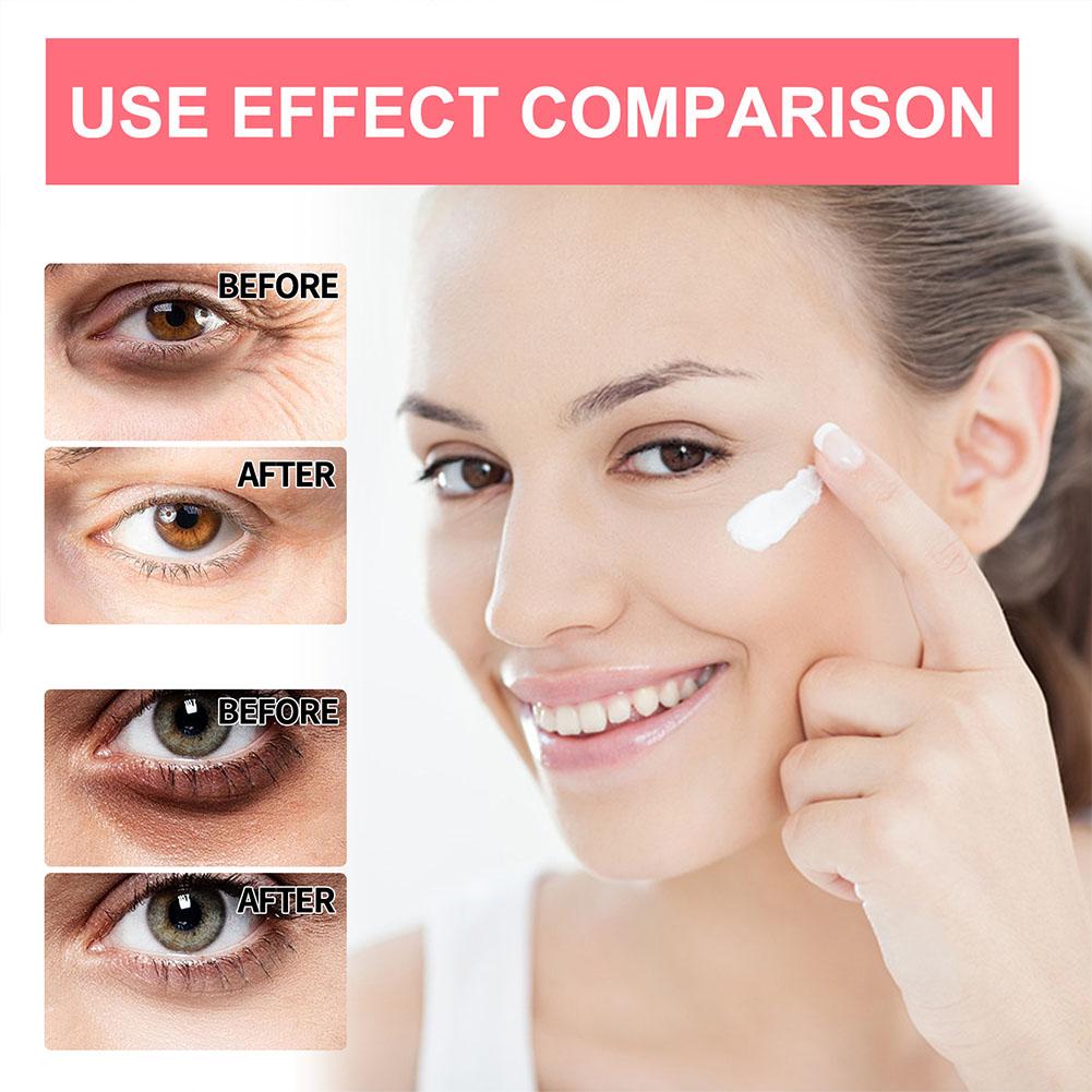 Best of Anti-wrinkle Eye Cream Retinol Anti Puffiness Remove Dark Circles Eye Bags Stick Fade Fine Line Whitening Moisturizing Skin Care Reviews & Tips - Image 5