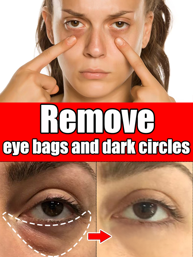 Best of Highly Effective Eye Cream Removal Bag Dark Circles Puffiness Fine Lines Eyes Reviews & Tips