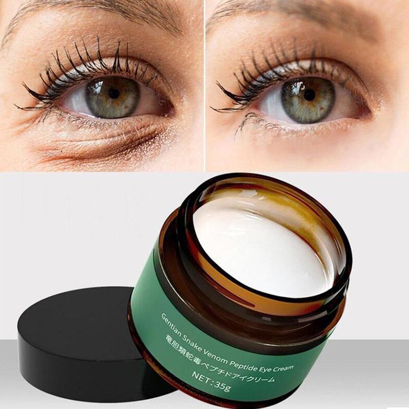 Best of Remove Eye Bags Eye Cream Retinol Cream Anti-Puffiness Gel Dark Circles Delay Aging Reduce Wrinkles Eye Cream Reviews & Tips