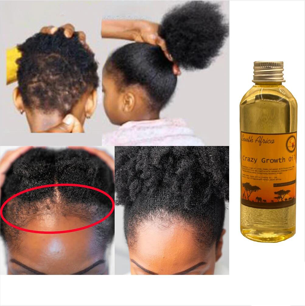 Best of Do This If Your Hair Isn’t Growing Africa Crazy Growth Oil For Hair Growth Chebe Powder Extraction Stop Hair Shrinkage Reviews & Tips