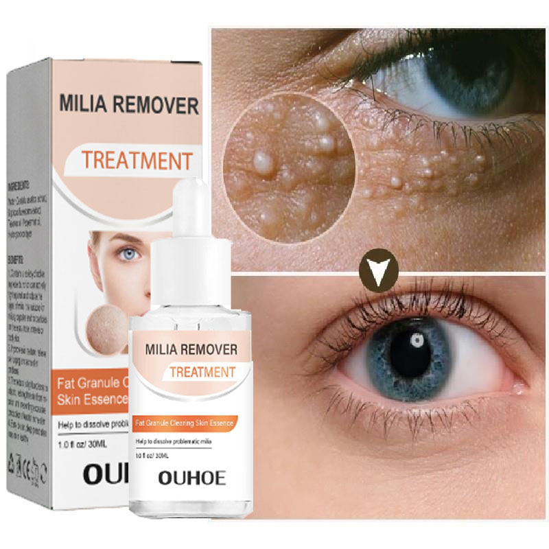 Best of Fat Granules Removal Eye Serum Anti Dark Circle Eye Bags Fade Fine Line Essence Anti-Puffiness Moisturizing Skin Care Products Reviews & Tips