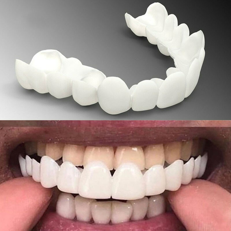 Best of Upper Lower Comfort Fit Flex Whitening Tooth Denture Veneer Braces Reviews & Tips