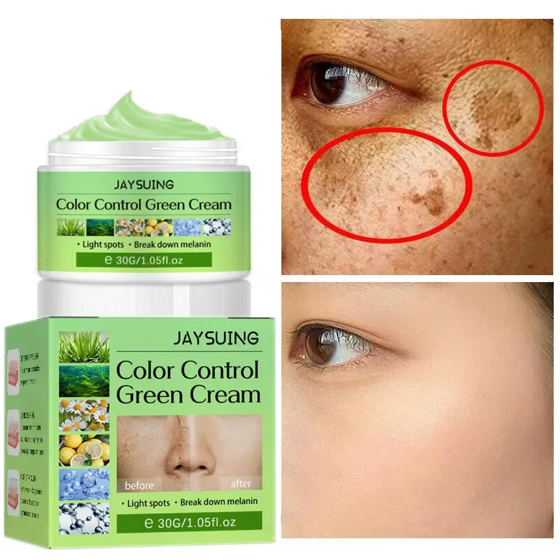 Best of Whitening Freckles Cream Face Remove Melasma Dark Spots Lighten Melanin Melasma Remover Moisturizing Brighten Skin Care 30ML Reviews & Tips