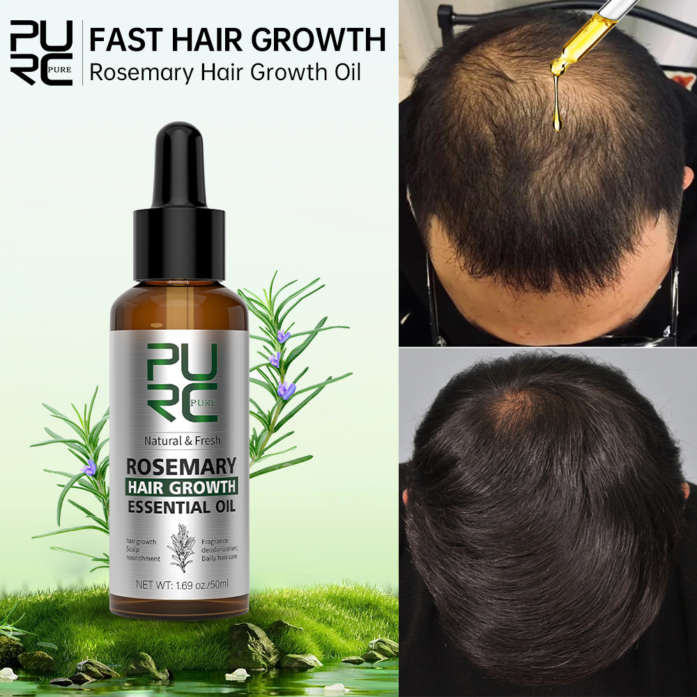 Best of PURC Rosemary Oil For Hair Growth Products Hair Loss Treatment Ginger Fast Hair Growing For Men And Women Hair Care Reviews & Tips