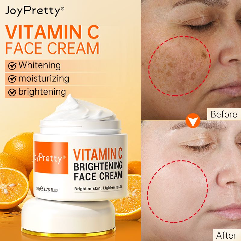 Best of Vitamin C For Face Cream Pigments Dark Spots Removal Whitening Facial Cream Lightening Skin Care Products Beauty Health Reviews & Tips