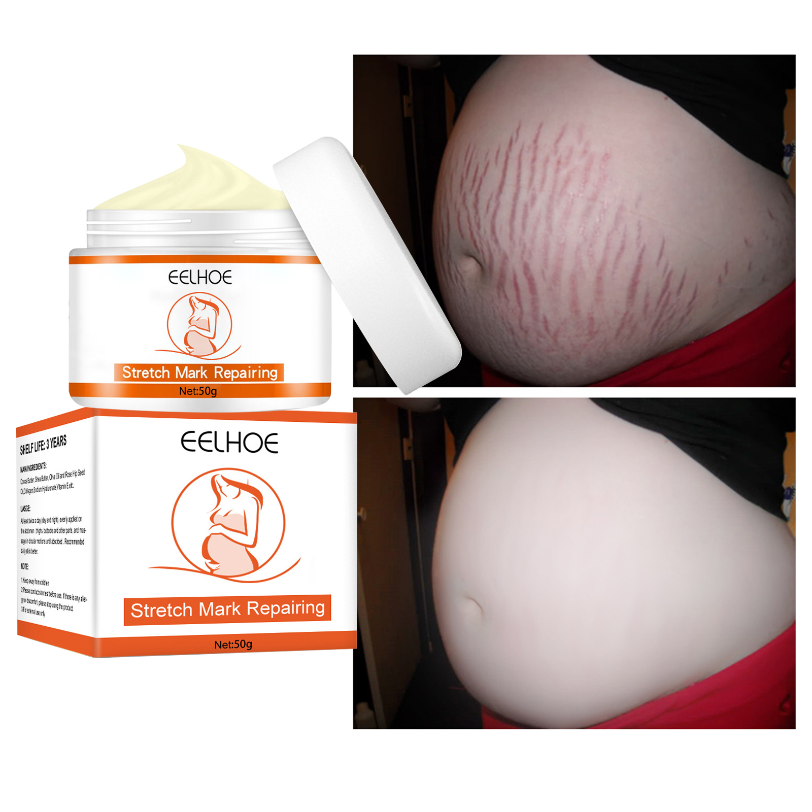 Best of Stretch Mark Cream Removal Pregnancy Mark Cream Repairs Damaged Skin Line Anti-Aging Anti-Winkles Firming Skin Care For Women Reviews & Tips