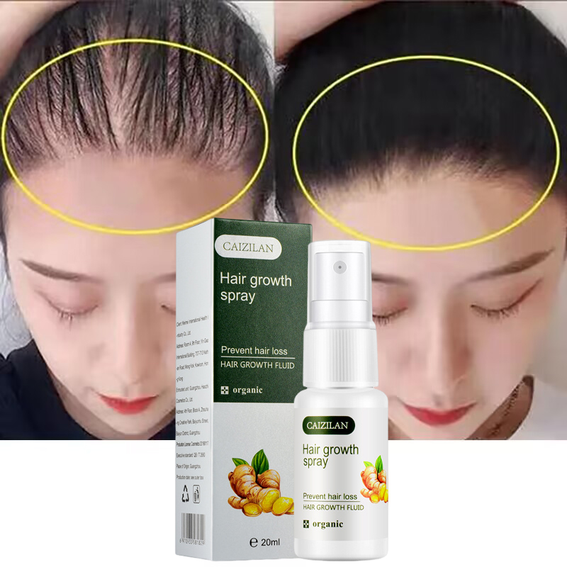 Best of Ginger Hair Growth Spray Serum Anti Hair Loss Treatment Fast Growing Products Prevent Hair Thin Dry Frizzy Damaged Repair Care Reviews & Tips