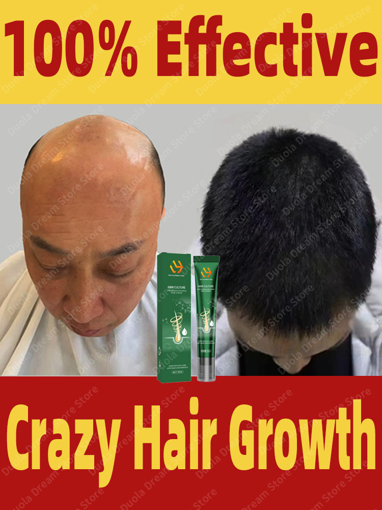 Best of Hair Growth Oil For Men Biotin Fast Treatment Baldness Serum Reviews & Tips