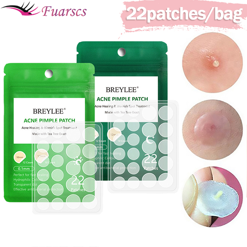 Best of 0.1mm Acne Pimple Patch Stickers Waterproof Acne Treatment Pimple Remover Tool Blemish Spot Facial Mask Skin Care 22 Patches / bag Reviews & Tips