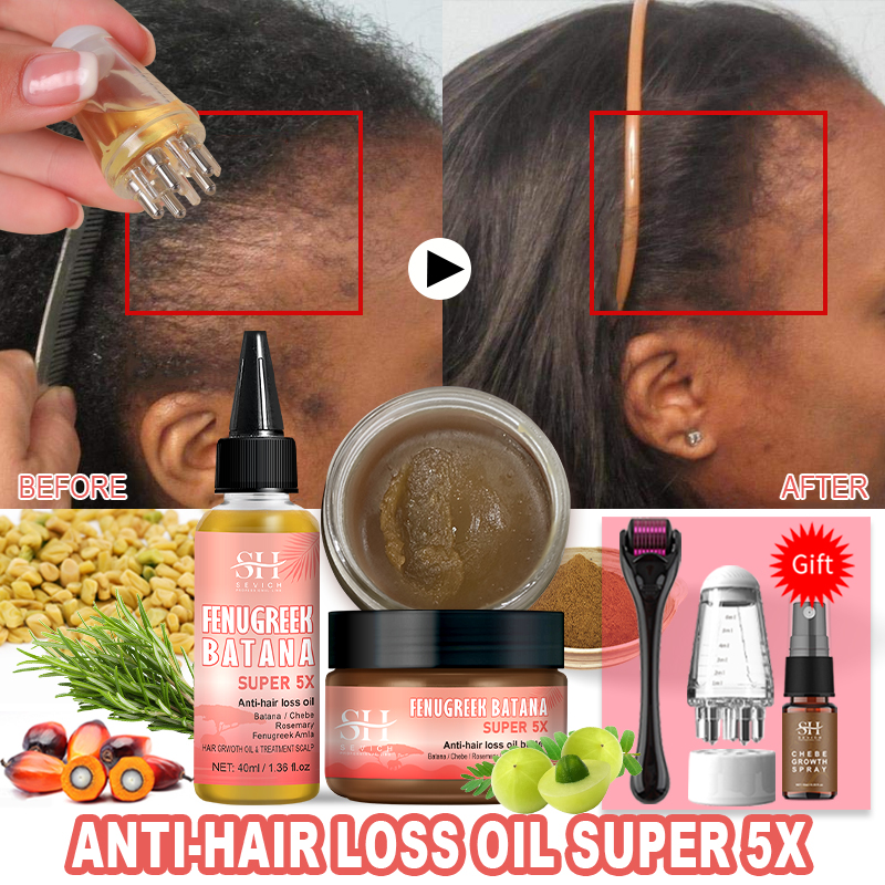 Best of 2024 Super 5x Hair Growth Oil Set Fenugreek Anti-Hair Loss Oil Rosemary Hair Regrowth Oil Chebe Batana Butter Hair Mask Amla Oil Reviews & Tips