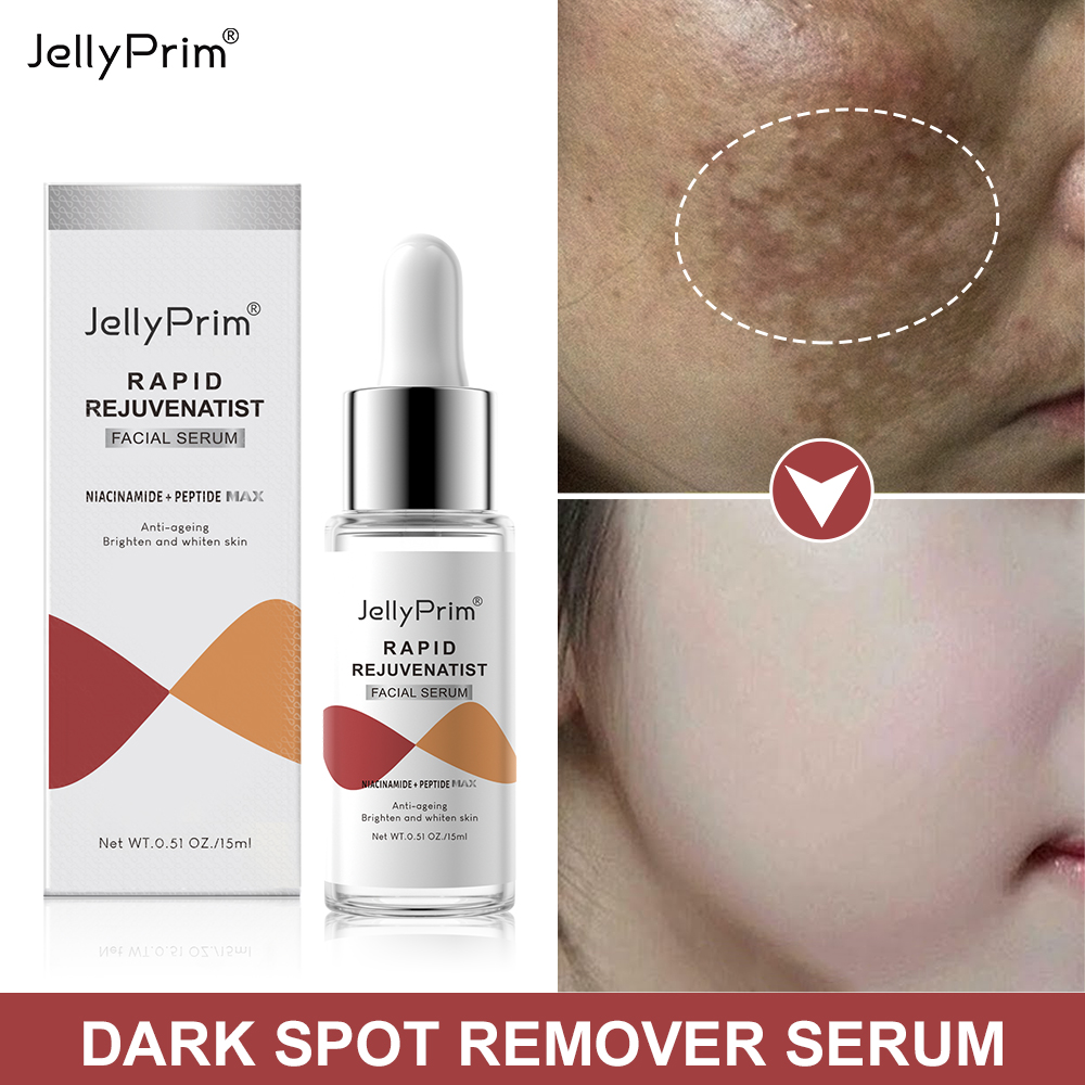 Best of Niacinamide Dark Spot Remover Serum For Face Whitening Moisturizer Hyaluronic Acid Removal Freckle Facial Serum Skin Care Reviews & Tips