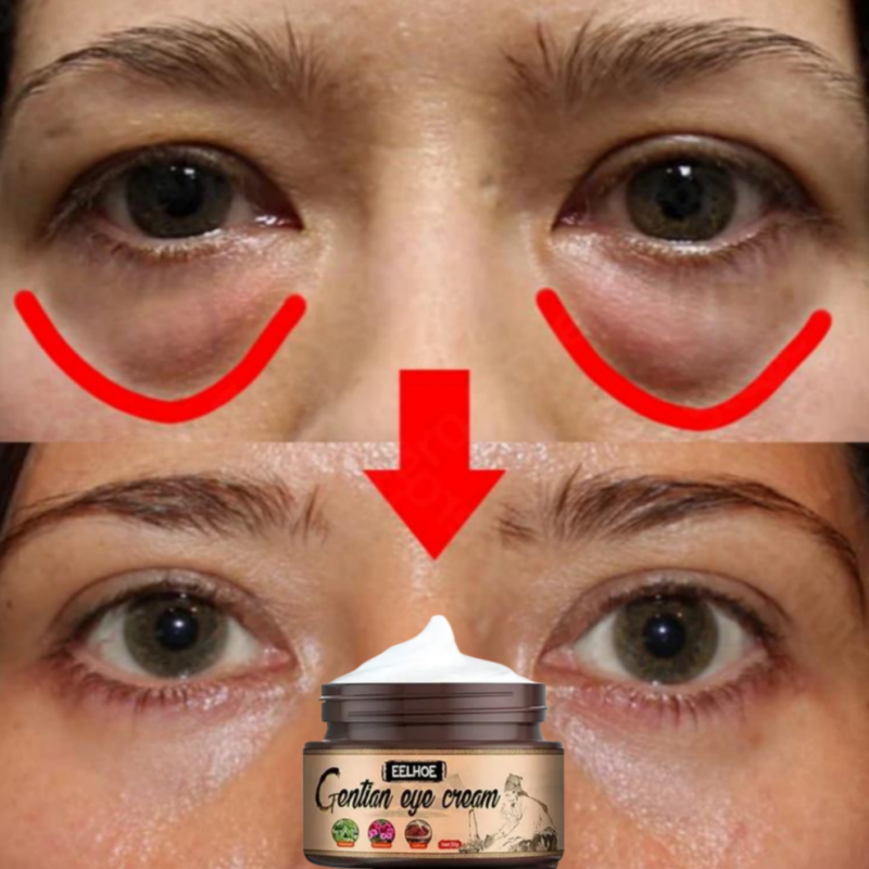 Best of Instant Eye Bags Remove Eye Cream Anti Fat Particles Dark Circles Under-Eye Puffiness Firming Wrinkles Korean Skin Care Product Reviews & Tips