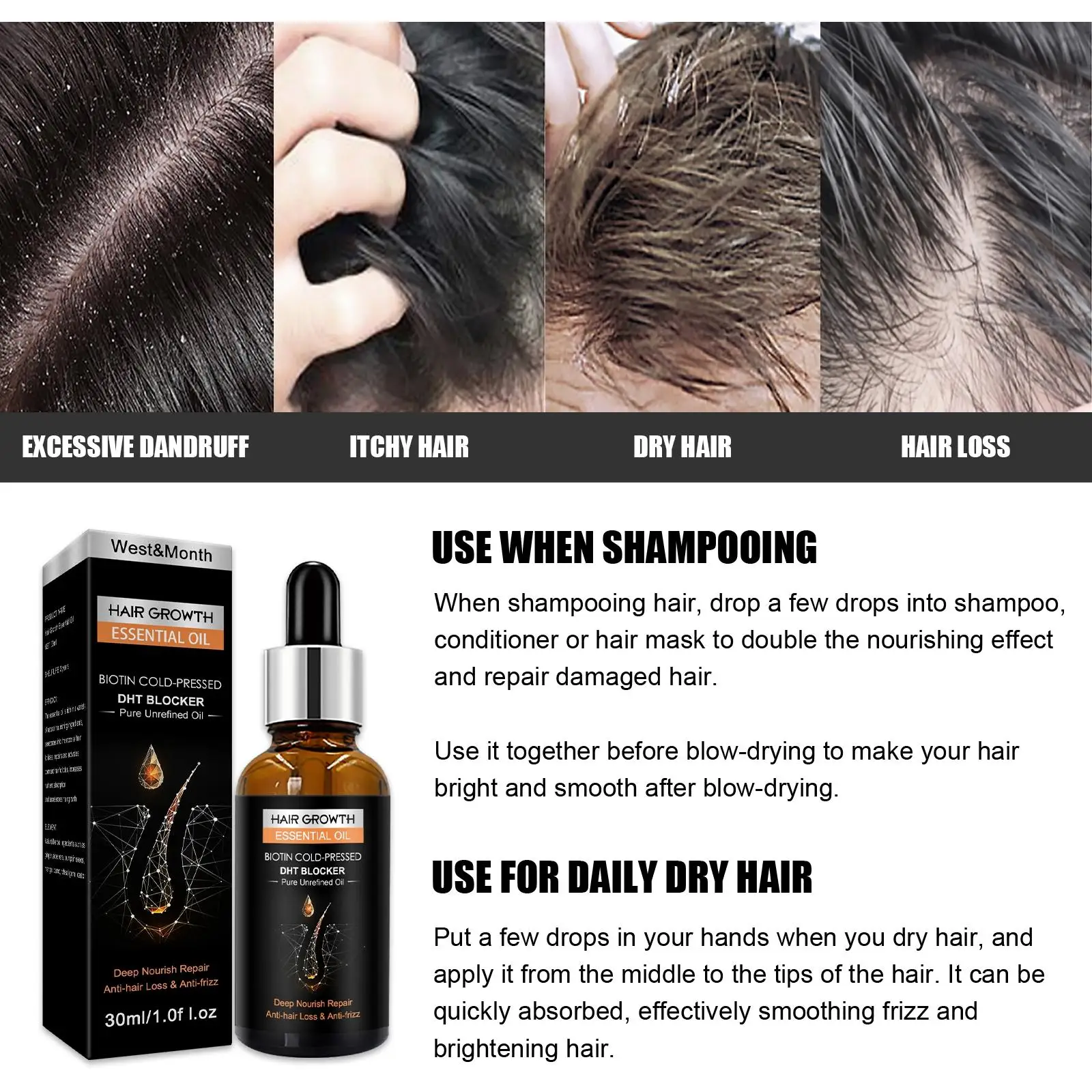 Hair Strengthening Oil Thickening Moisturizing For Dry Hair Types Women Men  - Hair & Scalp Treatments - AliExpress