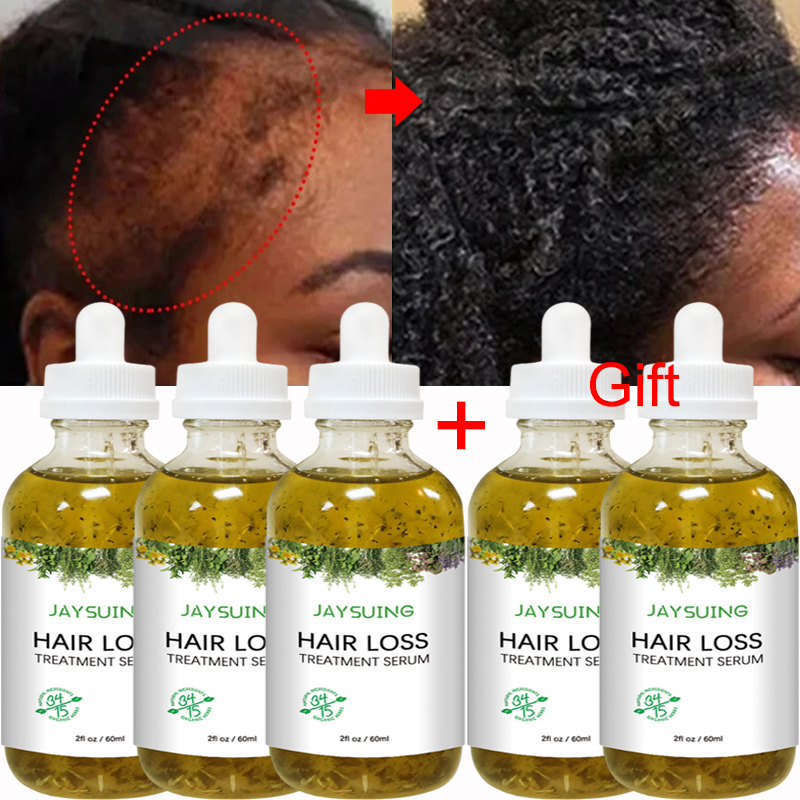 Best of New Fast Hair Growth Serum Hair Thinning Treatment Essential Oil Prevent Hair Loss Traction Alopecia Regrowth Care Beauty Health Reviews & Tips