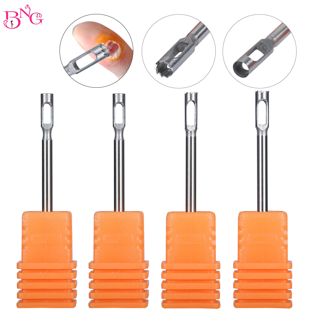 Best of Stainless Steel Medical Pedicure Drill Bit Faster Corn Remover Removal Foot Callus Cuticle Cutter Rotary Burr Bits Tool Reviews & Tips