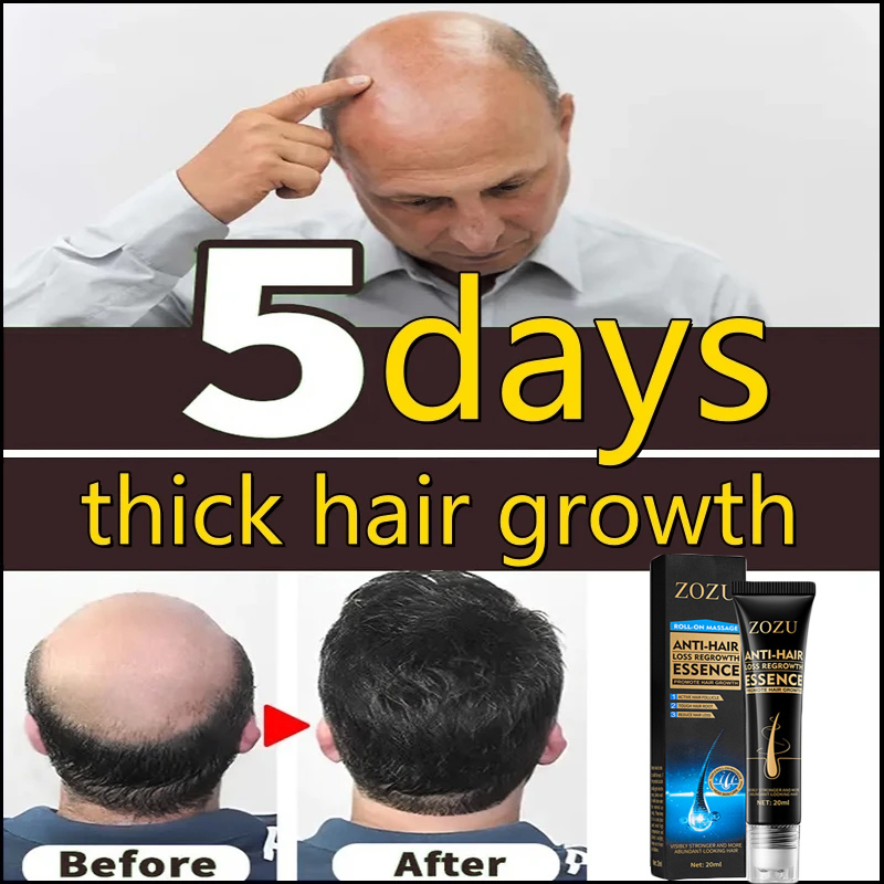 Best of Fast Hair Growth Essence Effective Anti Hair Loss Prevent Hair Dry Frizzy Damaged Repair Scalp Hair Follicle Care Men Women Reviews & Tips