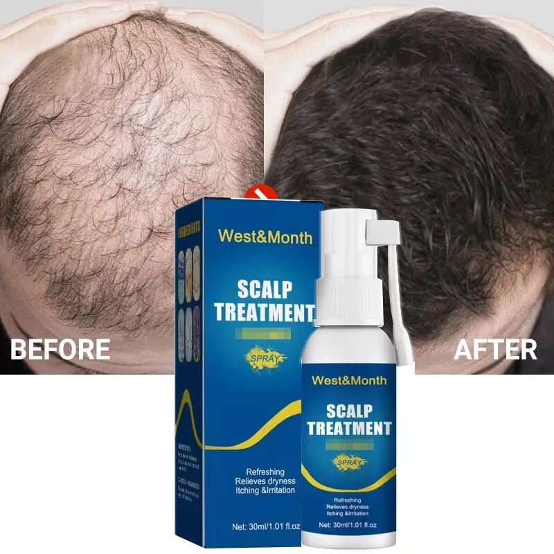 Best of Hair Growth Products Fast Growing Hair Serum Spray Anti Hair Loss Treatment Essential Oil Repair Nourish Hair Root For Men Women Reviews & Tips