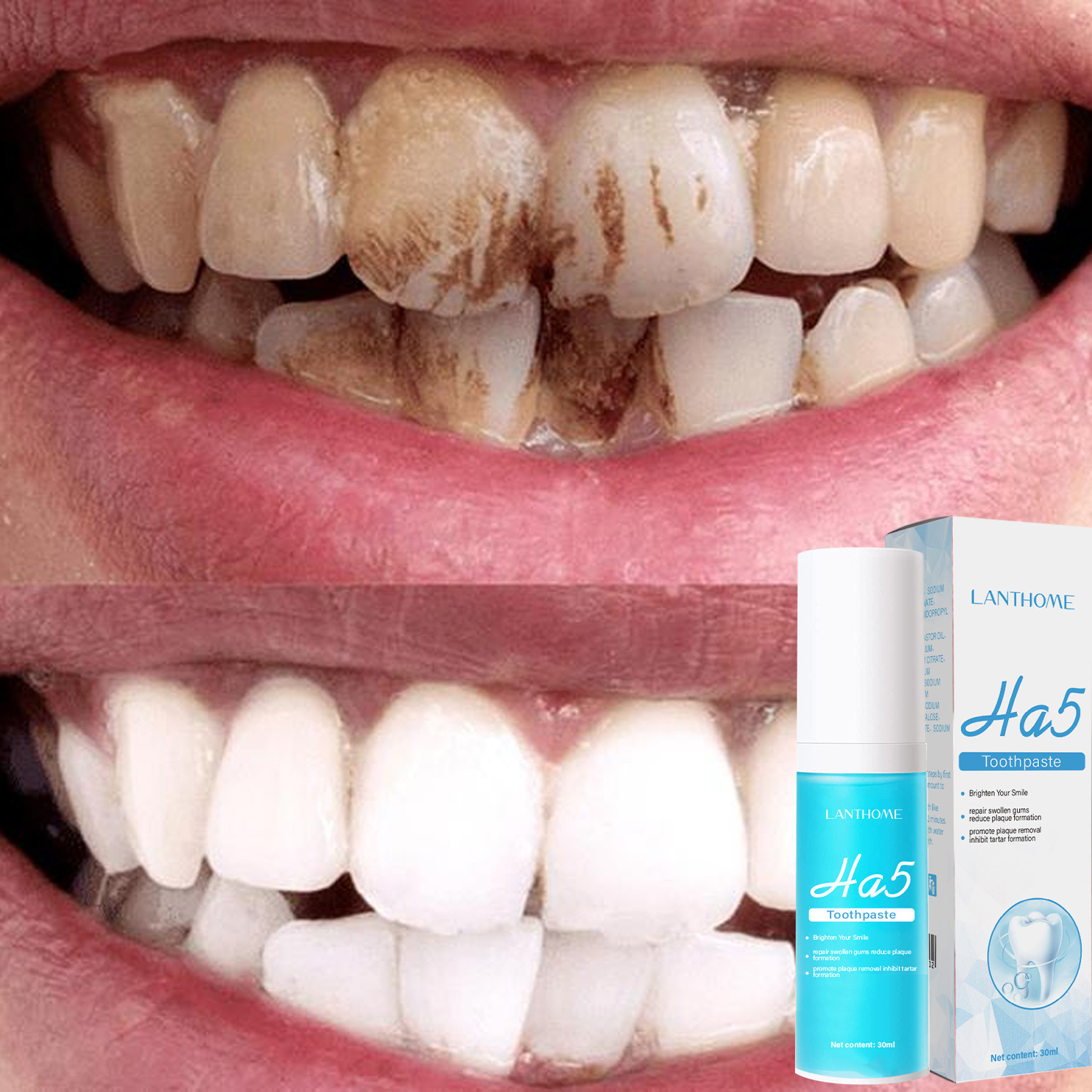 Best of HA5 Repair Toothpaste Teeth Whitening Remover Plaque Stain Prevent Periodontitis Cleaning Oral Hygiene Fresh Breath Dental Tools Reviews & Tips