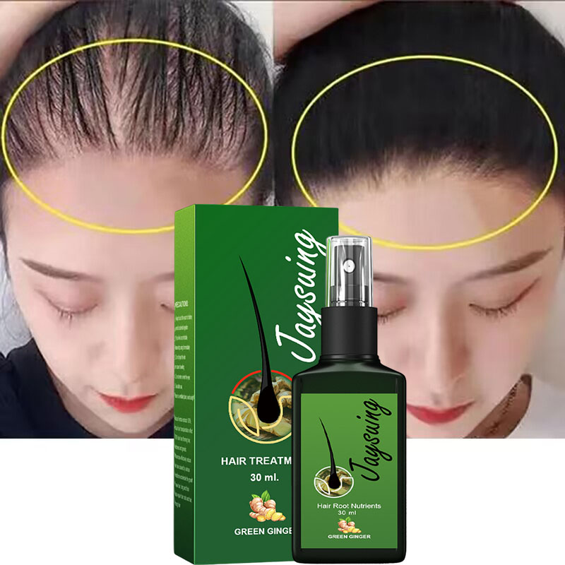 Best of Fast Hair Growth Spray Anti Hair Loss Serum Prevent Baldness Scalp Treatment Repair Dry Damaged Beard Hair Care For Men Women Reviews & Tips