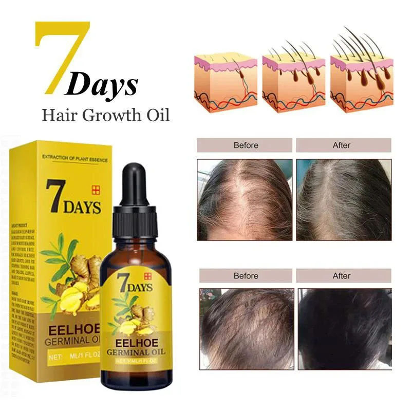 Best of 5pcs 7 Days Fast Ginger Hair Growth Serum Anti Hair Loss Fast Growing Hair Care Essential Oil Repair Damaged For Women Men 200ML Reviews & Tips - Image 5