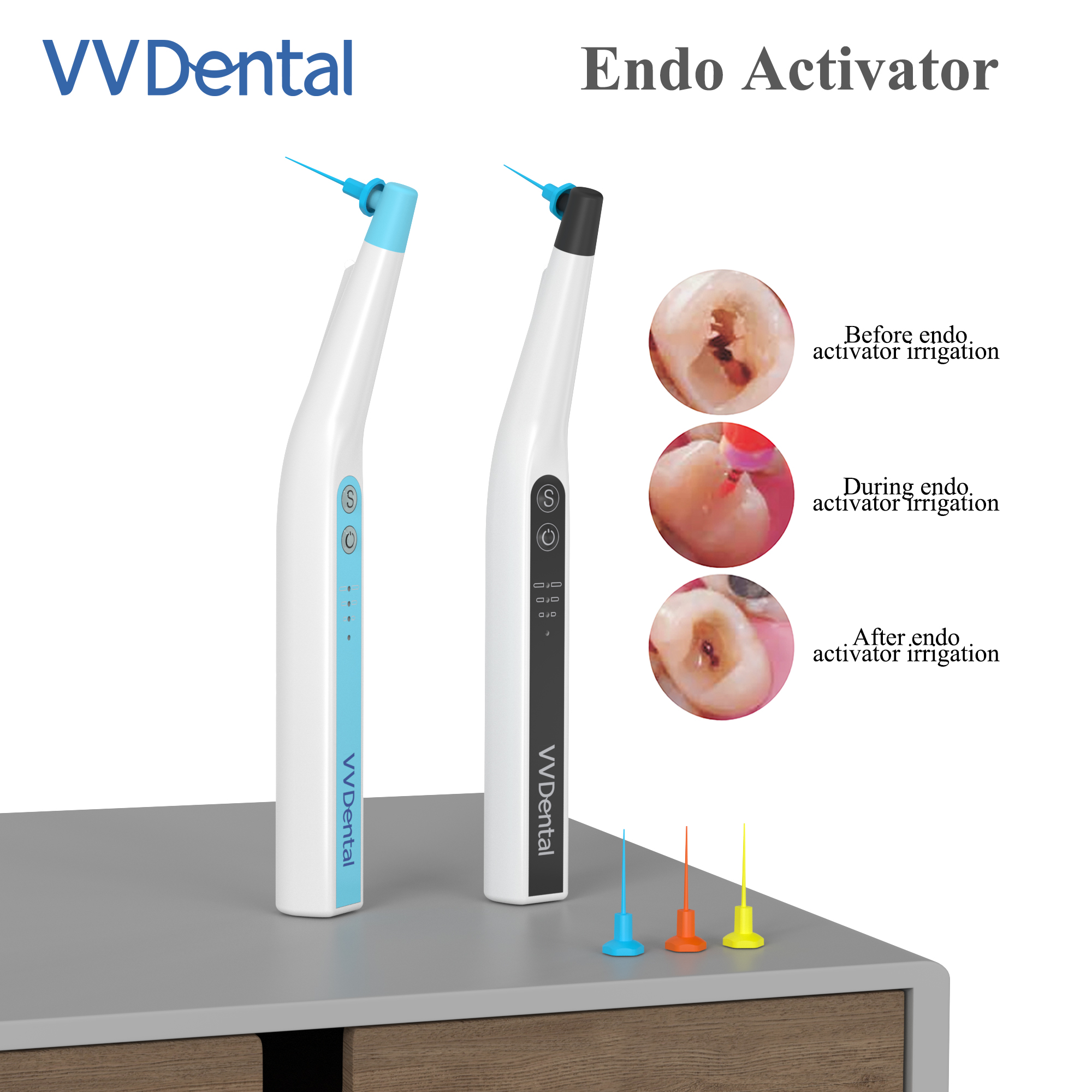 Best of VV Dental Root Canal Sonic Irrigator Activator With 60 Pcs Endo Files For Endodontic Cleaning New Dentistry Instrument Free Ship Reviews & Tips