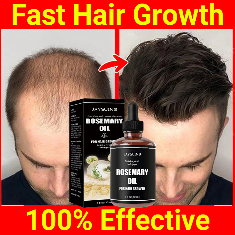 Best of Rosemary Hair Growth Serum Fast Growing Hair Care Essential Oil Anti Seborrheic Hair Loss Postpartum Baldness Products Men Women Reviews & Tips