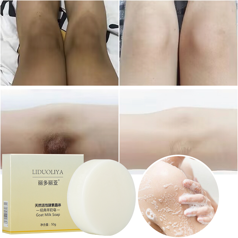 Best of Body Whitening Soap Chicken Skin Removal Underarm Knees Bleaching Soap Dark Spot Removal Dead Skin Moisturizing Body Treatment Reviews & Tips