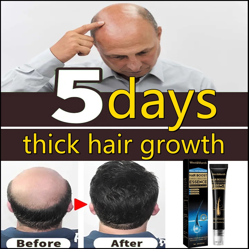 Best of Fast Hair Growth Essence Effective Anti Hair Loss Serum Baldness Repair Hereditary Postpartum Seborrheic Hair Loss Hair Care Reviews & Tips