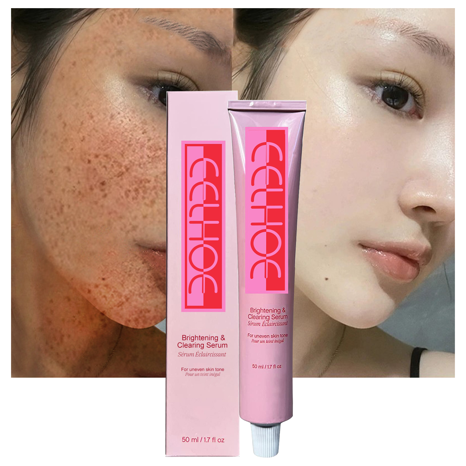 Best of Effective Whitening Freckle Cream Fade Dark Spot Whitening Essence Removal Melanin Melasma Lighten Brighten Smooth Skin Care Reviews & Tips