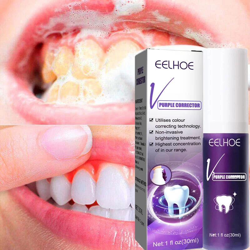 Best of Whitening Tooth Toothpaste Removal Smoke Stains Oral Hygiene Clean Effectively Freshen Breath Removal Yellow Teeth Dental Care Reviews & Tips