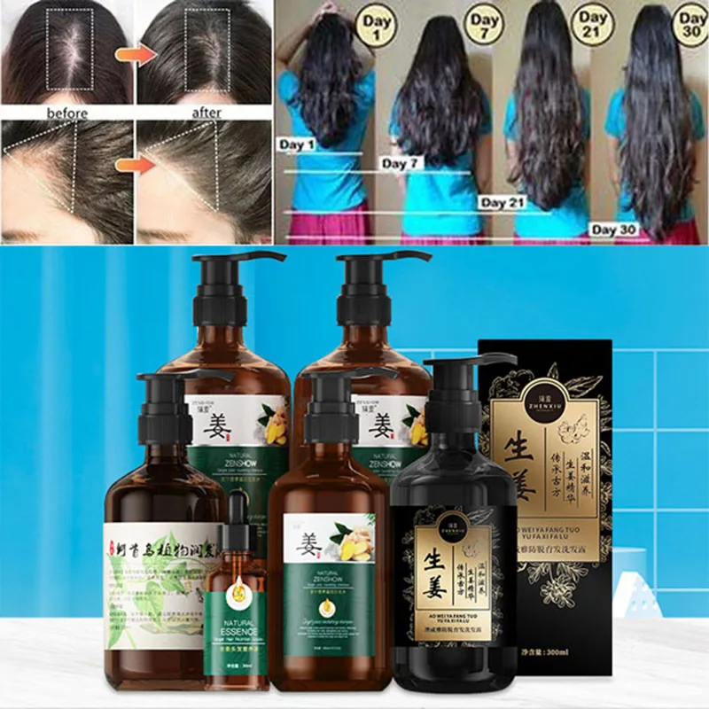 Best of Hair Care Ginger Shampoo Hair Growth Products Natural Anti Hair Loss Fast Growing Prevent Baldness Repair Scalp Frizzy Damaged Reviews & Tips