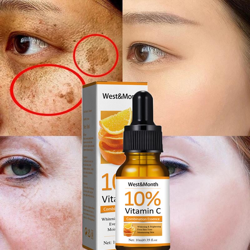 Best of Vitamin C Whitening Freckle Face Serum Remove Melasma Dark Spot Fade Melanin Dull Moisturizing Brighten Smooth Skin Care Product Reviews & Tips