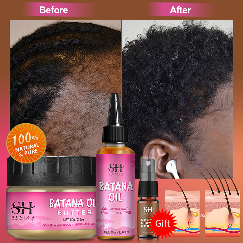 Best of Fast Hair Growth Set Batana Oil Traction Alopecia Hair Mask Anti Break Loss Hair Growth Oil Baldness Treatment Batana Essential Reviews & Tips