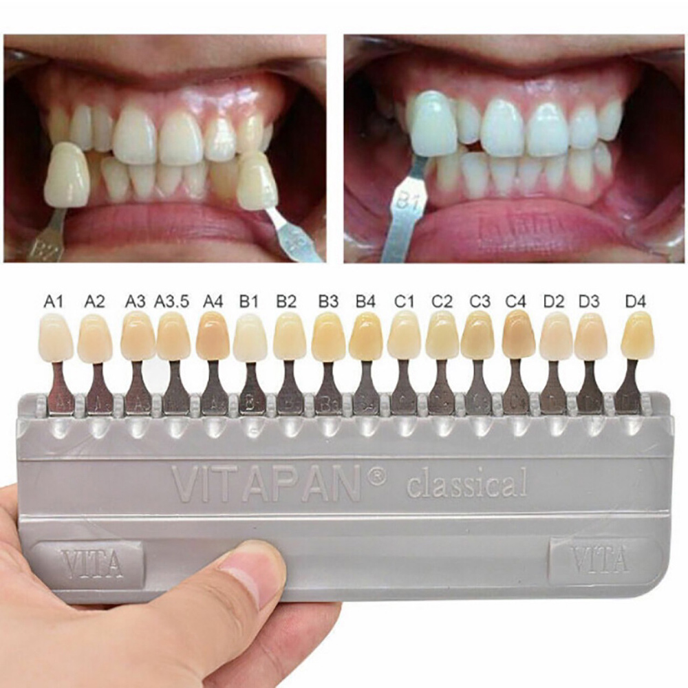 Best of Denspay Tooth Whitening Products Tooth Whitening Products Guide Tooth Model Colorimetric Plate Dental Color Scale Reviews & Tips - Image 6