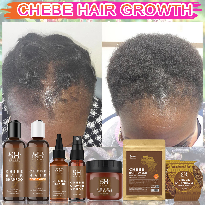 Best of Fast Hair Growth Set Chebe Oil Traction Alopecia Hair Strengthen Mask Anti Break Loss New Africa Baldness Treatment Care Essence Reviews & Tips