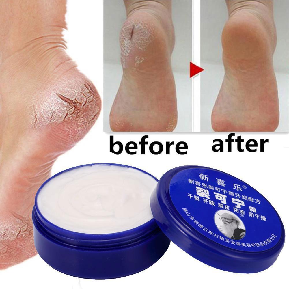 Best of 2023 New Hand Foot Anti-cracking Cream Anti-Drying Crack Foot Cream Heel Cracked Repair Cream Removal Dead Skin Hand Feet Care Reviews & Tips - Image 3