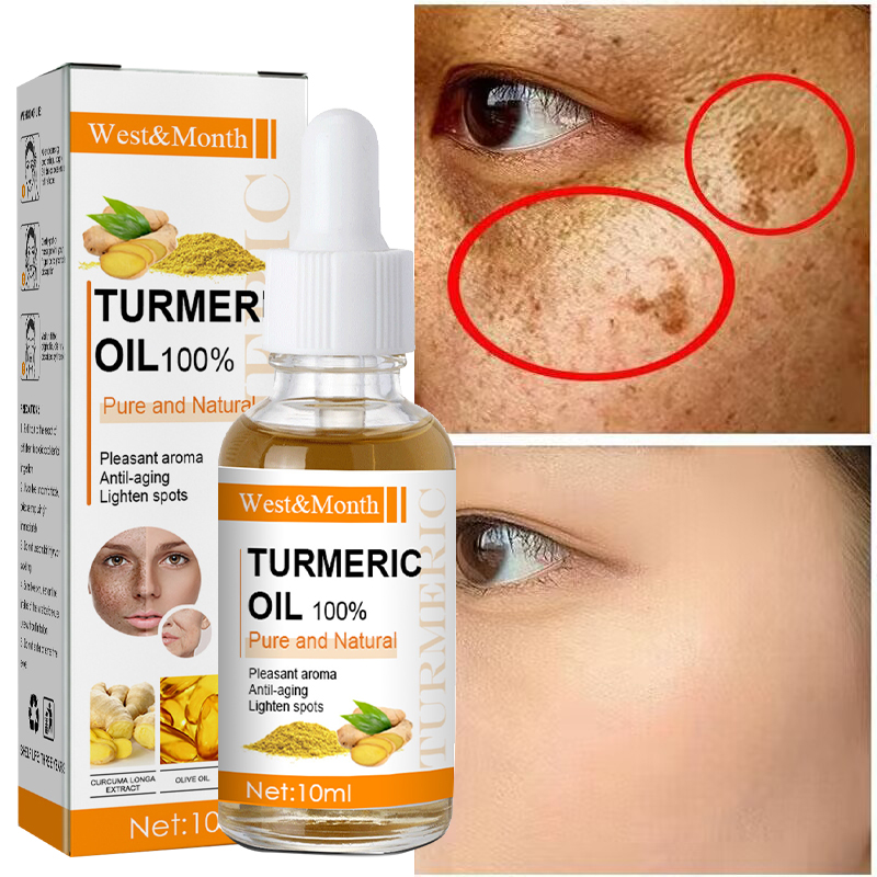 Best of Turmeric Whitening Freckles Serum Fade Dark Spot Melasma Remove Pigment Melanin Correcting Face Essence Improve Dull Skin Care Reviews & Tips