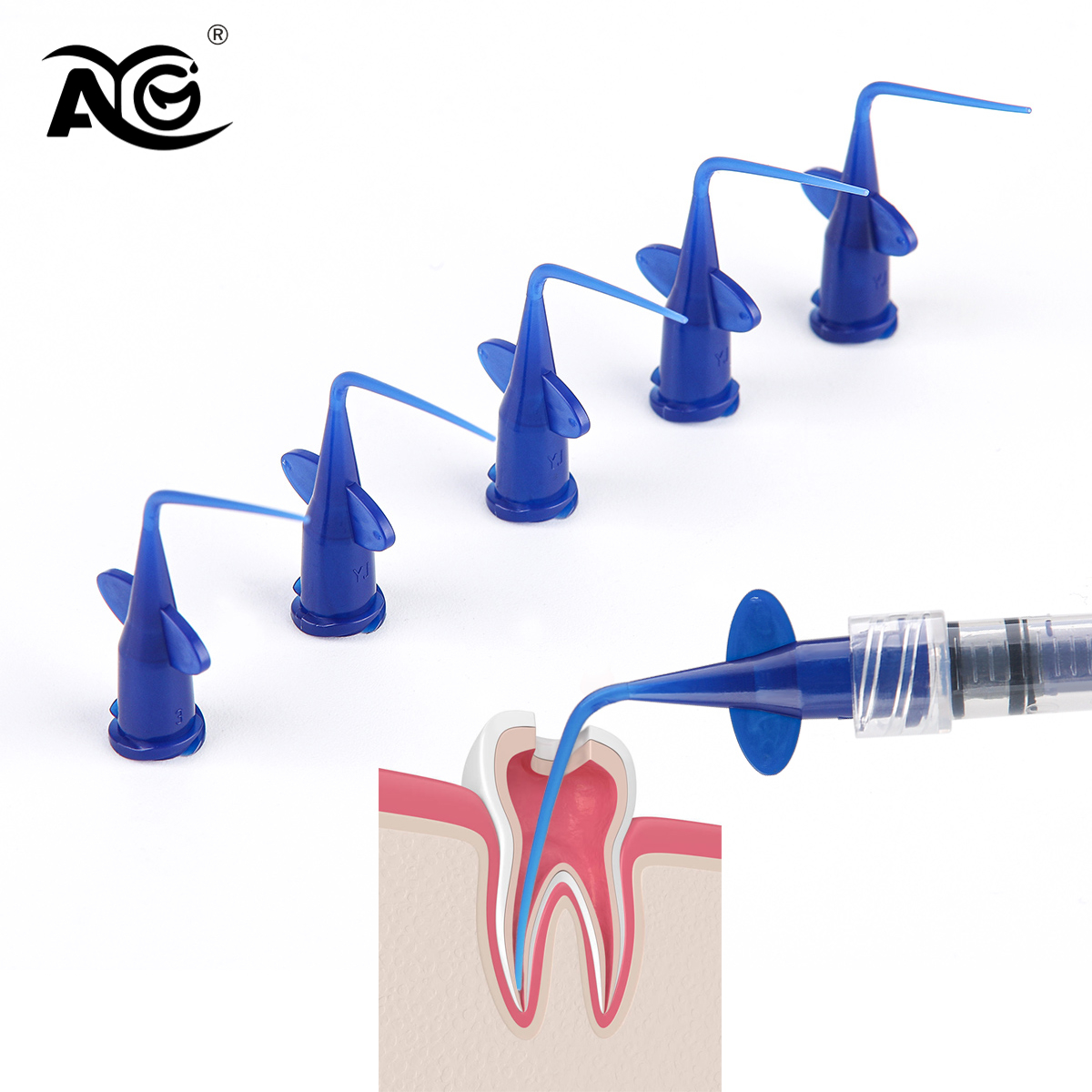 Best of AG DENGT 50 / 100 / 200Pcs Teeth Whitening Dental Irrigation Tips Blue Dental Disposable Syringe Tip Dental Irrigation Tips Reviews & Tips