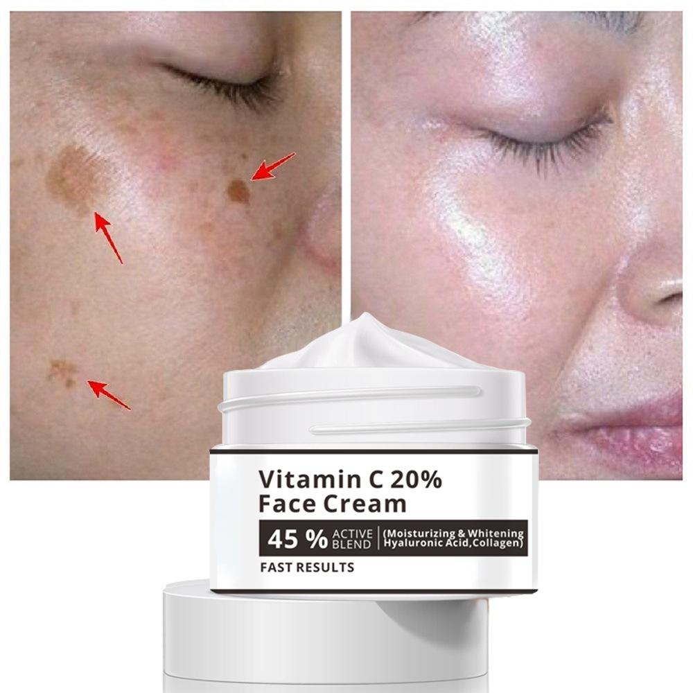 Best of Effective Whitening Freckle Cream Remove Melasma Acne Spot Pigment Melanin Dark Spots Pigmentation Moisturizer Skin Care Reviews & Tips